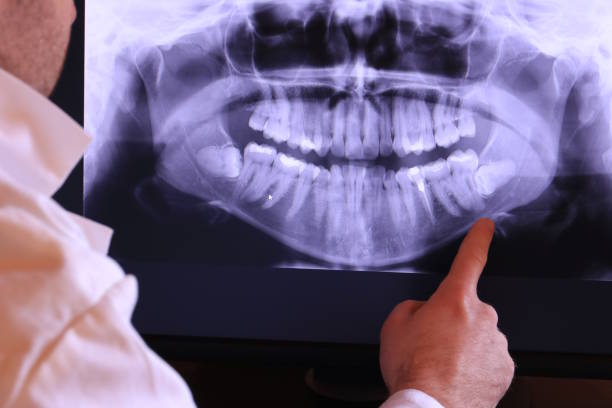 Best Emergency Tooth Extraction in Turner, OR