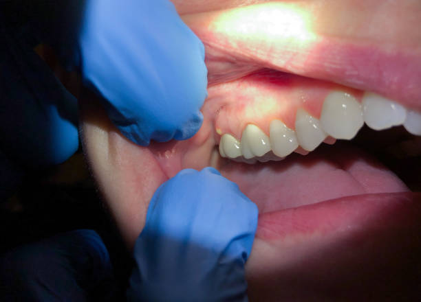 Best Emergency Dental Surgery in Turner, OR